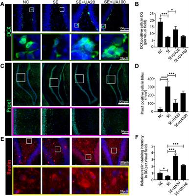 Ursolic Acid Protects Neurons in Temporal Lobe Epilepsy and Cognitive Impairment by Repressing Inflammation and Oxidation